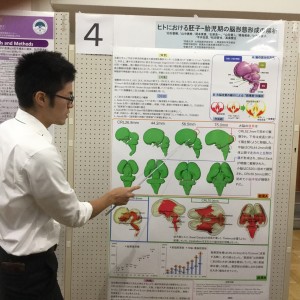 2016年度日本先天異常学会で発表: 白石さんが「2016年度日本先天異常学会奨励賞」受賞