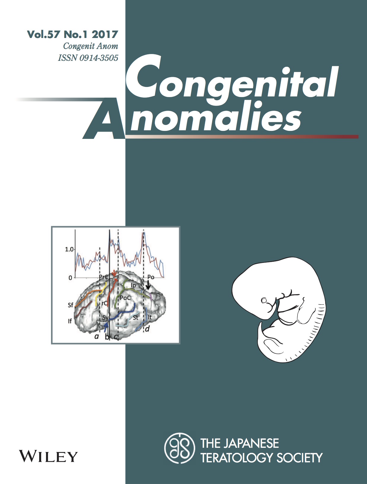 吉田さんの卒論がCongenit Anomに掲載