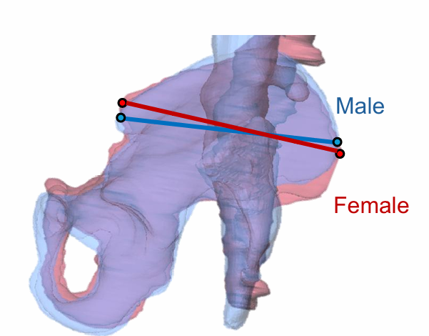 骨盤の男女差はいつごろから始まっているのか-ヒト胎児の骨盤傾斜と腰仙椎の向きを解析-