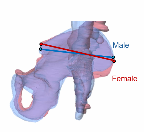 骨盤の男女差はいつごろから始まっているのか-ヒト胎児の骨盤傾斜と腰仙椎の向きを解析-