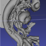 3DスキャンしたCS12胚子モデル