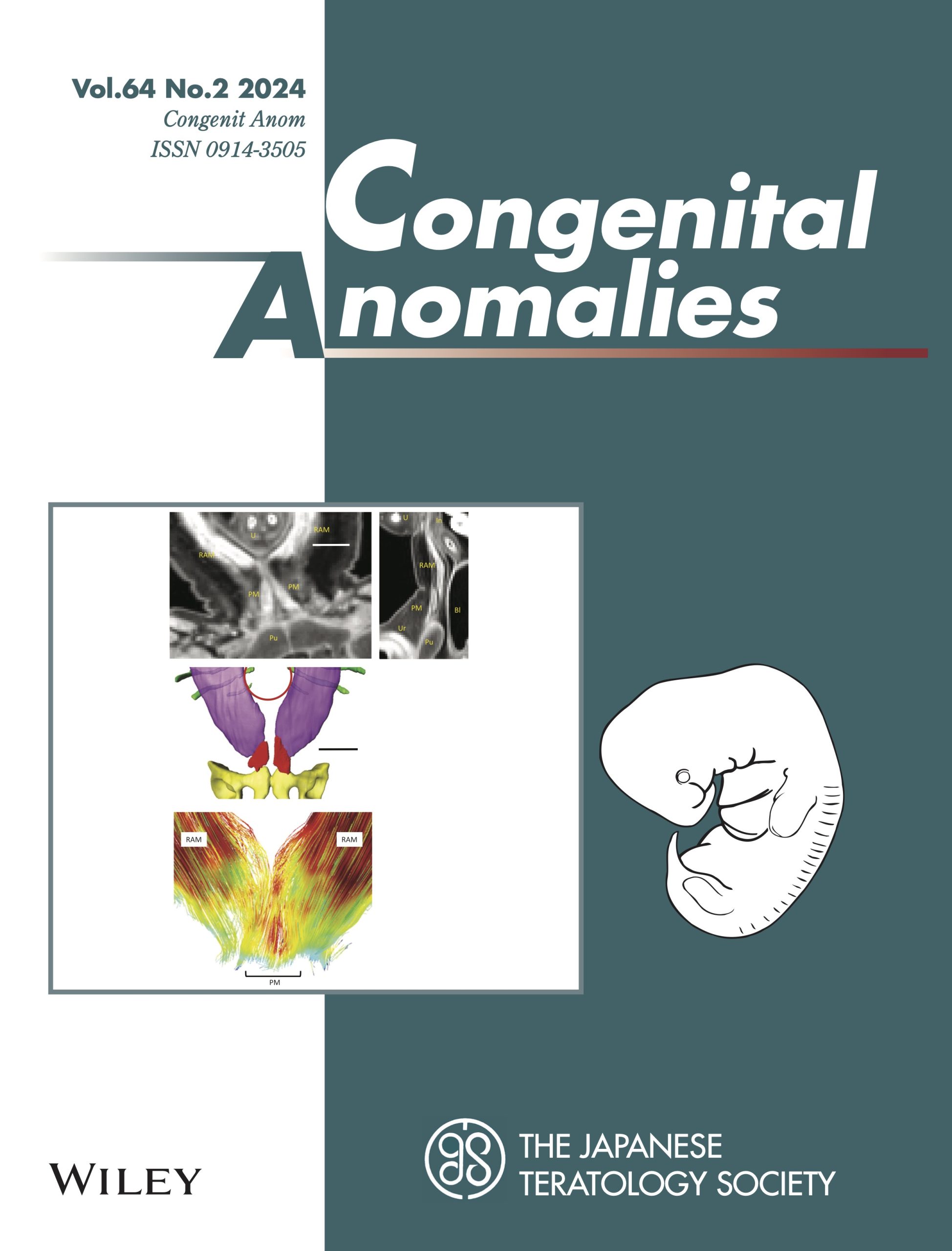 岩佐さんの論文がCongenit Anomに掲載