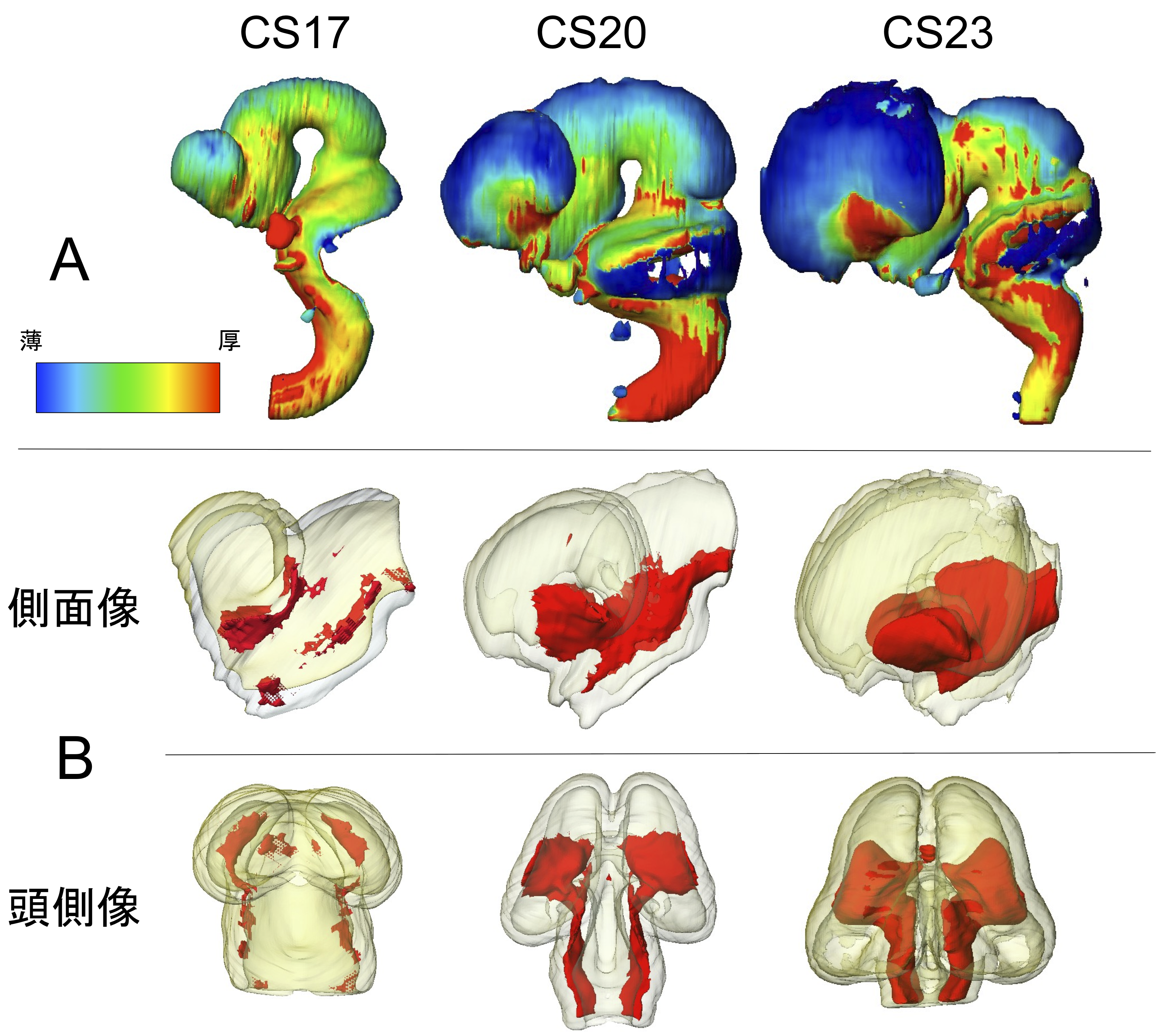 ヒト胚子期における脳形態形成の解析, NeuroImage, Data in Briefに掲載