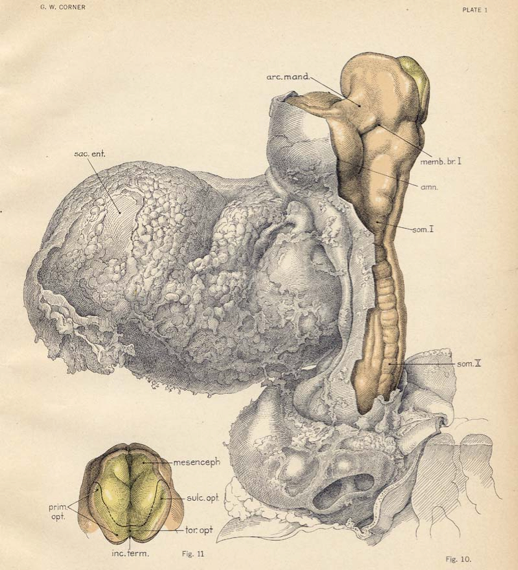 St. 10のヒト胚子 (Didusch 1929)