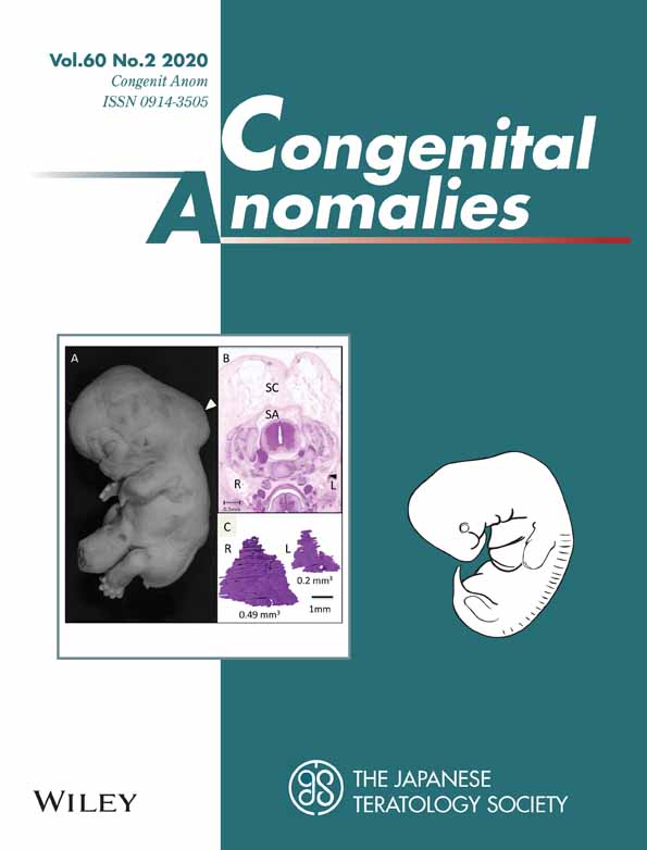 大賀さんの卒業論文がCongenit Anomに掲載