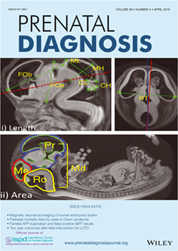 小林さんの卒論がPrenatal Diagnosisに掲載&表紙に採用