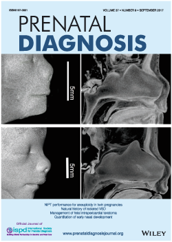 勝部先生の論文の図がprenatal Diagの表紙に採用