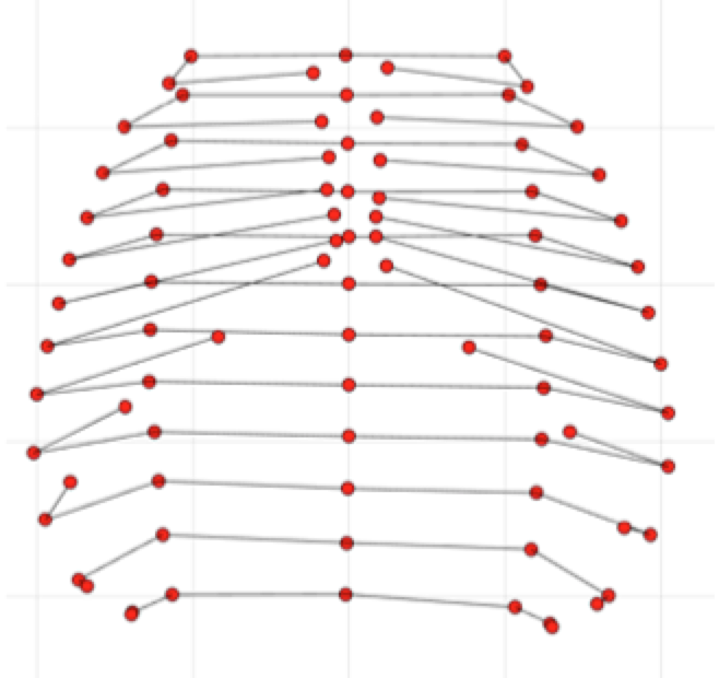 奥野さんの卒業論文がAnat Recに掲載