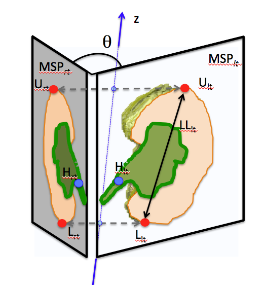 腎臓の回転、移動についての論文がAnat Recに掲載
