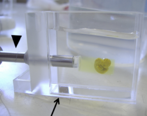 位相コントラストX線CT