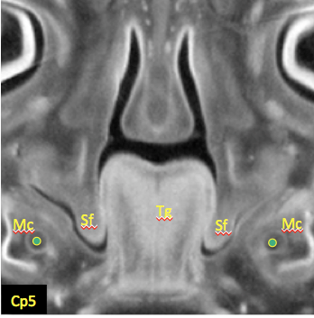 野原さんの修士論文がJ Anatに掲載