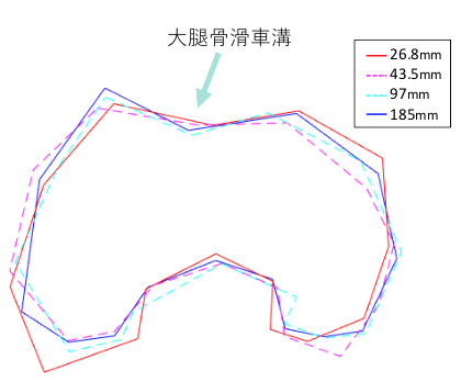 第48回日本整形外科スポーツ医学会学術集会で発表