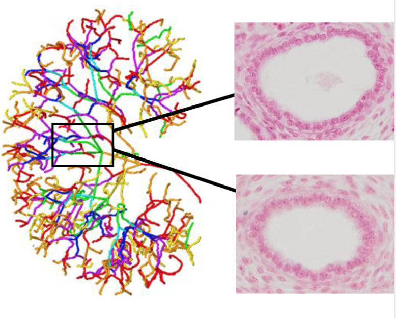 Marieさんの論文がPLos Oneに掲載