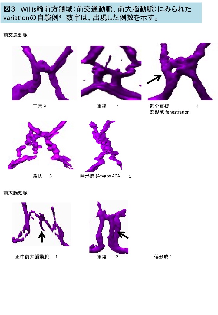 古市さんの卒論がAnat Recに掲載