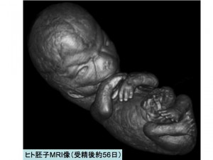 ヒト胚子透過立体回転画像が知的財産に登録…