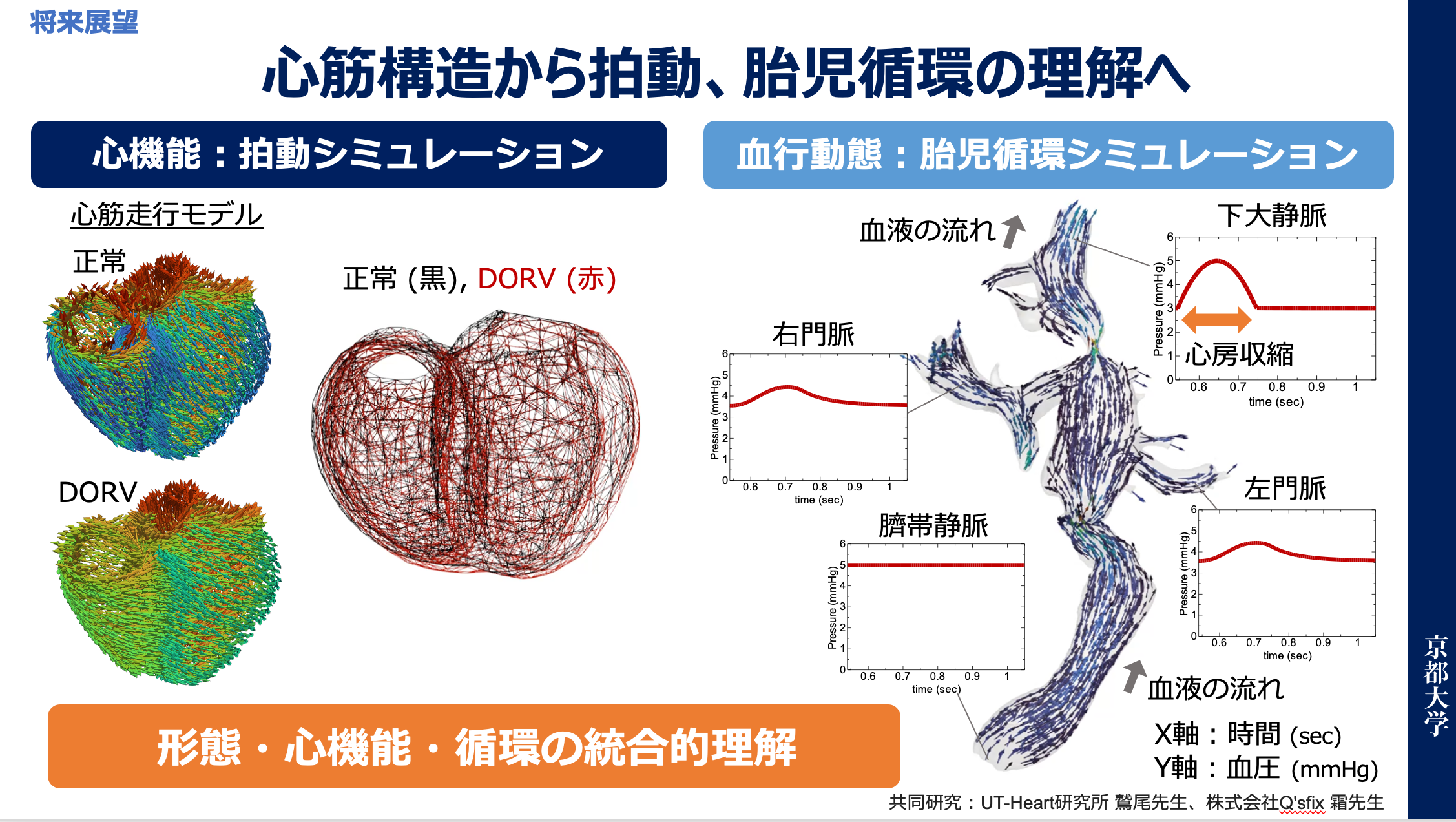 第62回 日本小児循環器学会総で発表