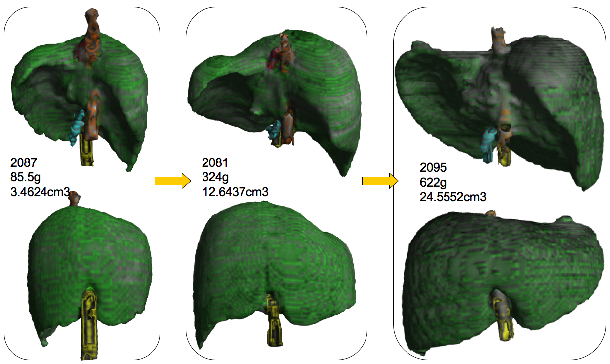ヒト胎児の肝臓形態形成; Hepatol Resに掲載(濱部卒論)