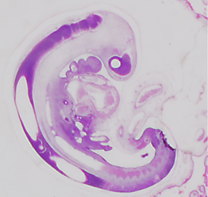 連続組織切片のデジタル化